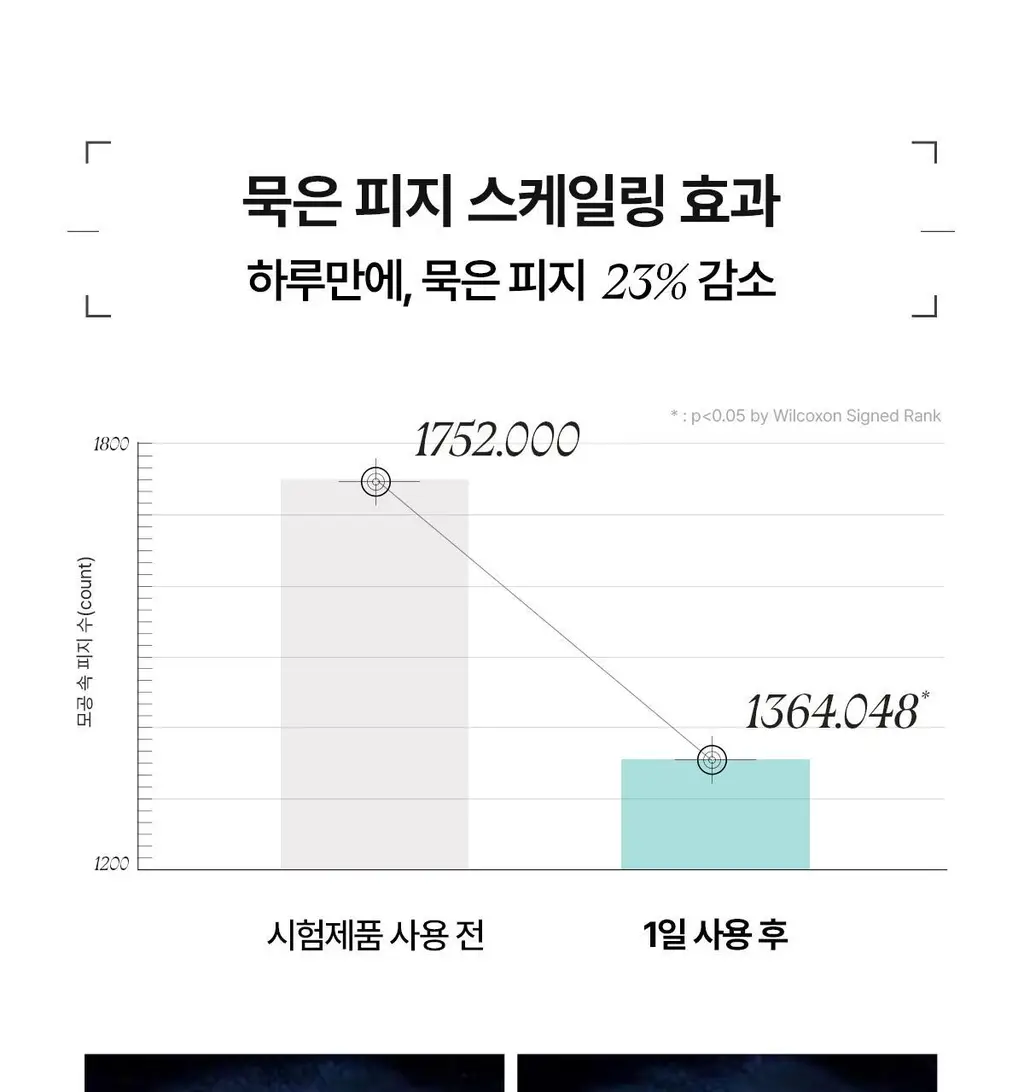 [1+1 트러블앰플/피지케어] 아떼 아크네솔 프로그래밍 앰플 듀오 기획 상세페이지 21